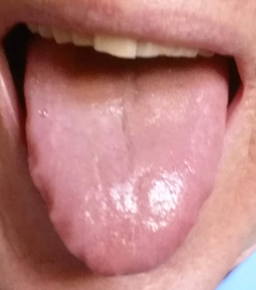 tongue-diagnosis-acupuncture-points